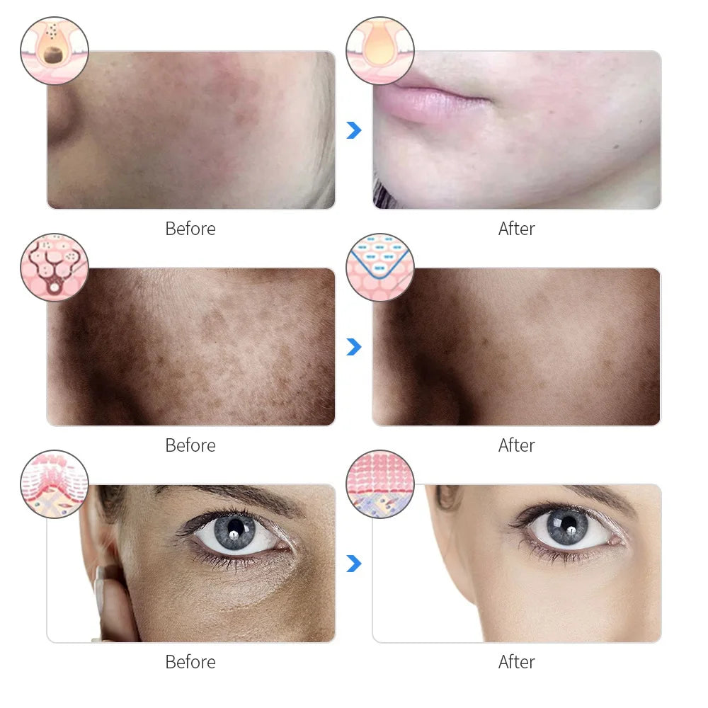 Máscara LED Facial Recargable – 7 Colores Fototerapia