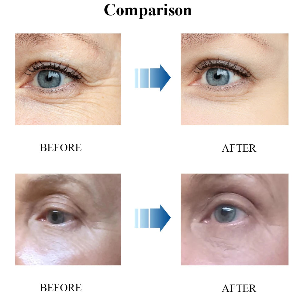 Contorno de Ojos – Elimina Ojeras y Bolsas | Hidratante Antiedad con Cosmética Coreana